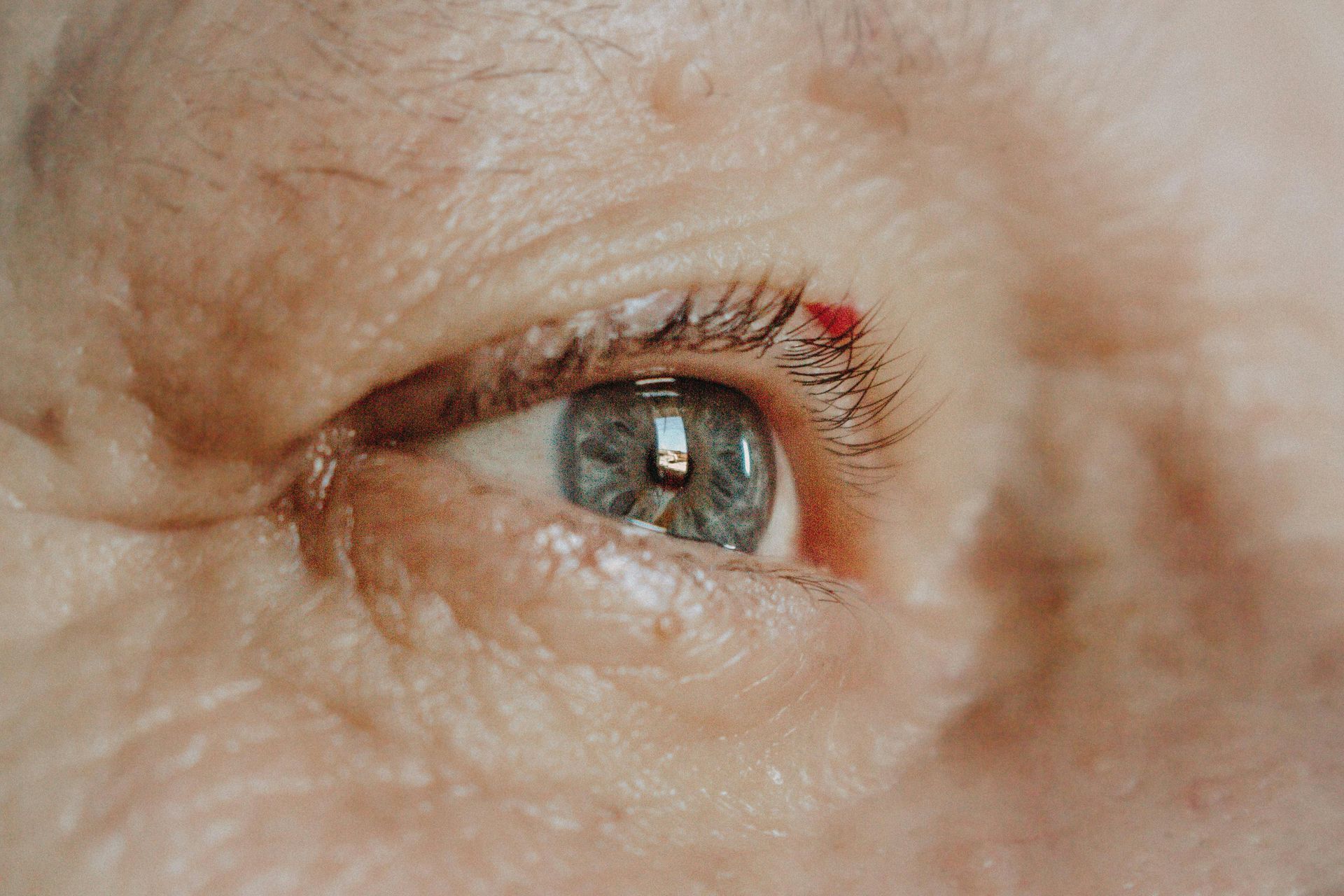 A close up of an elderly woman 's eye with a red spot on it.