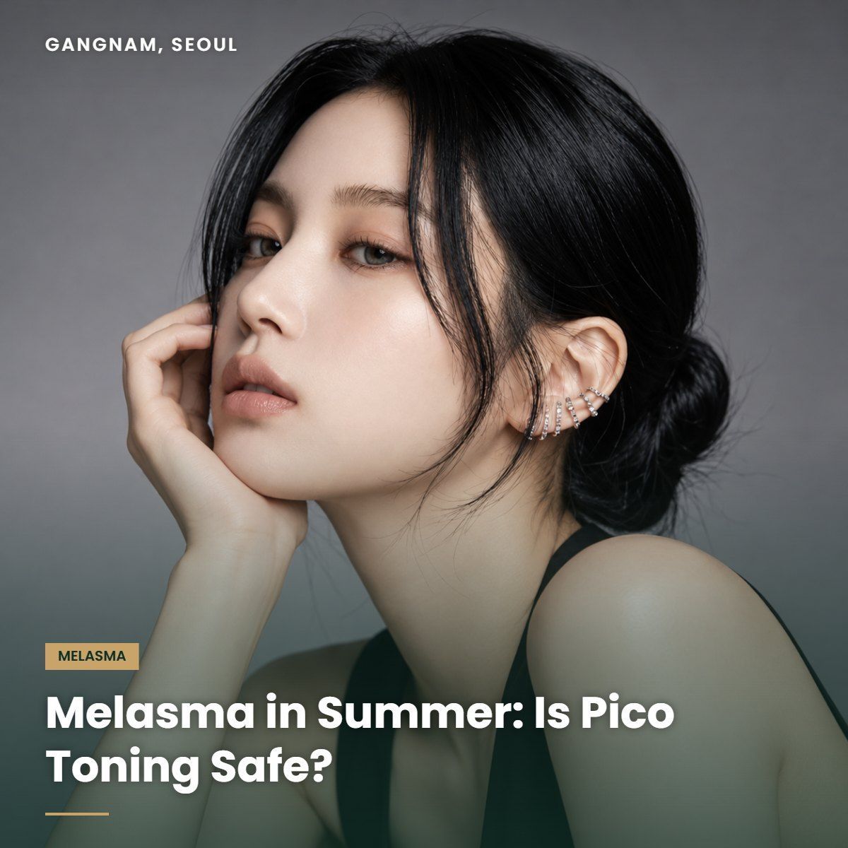 Pico toning for melasma at YAAN Clinic Gangnam, Seoul