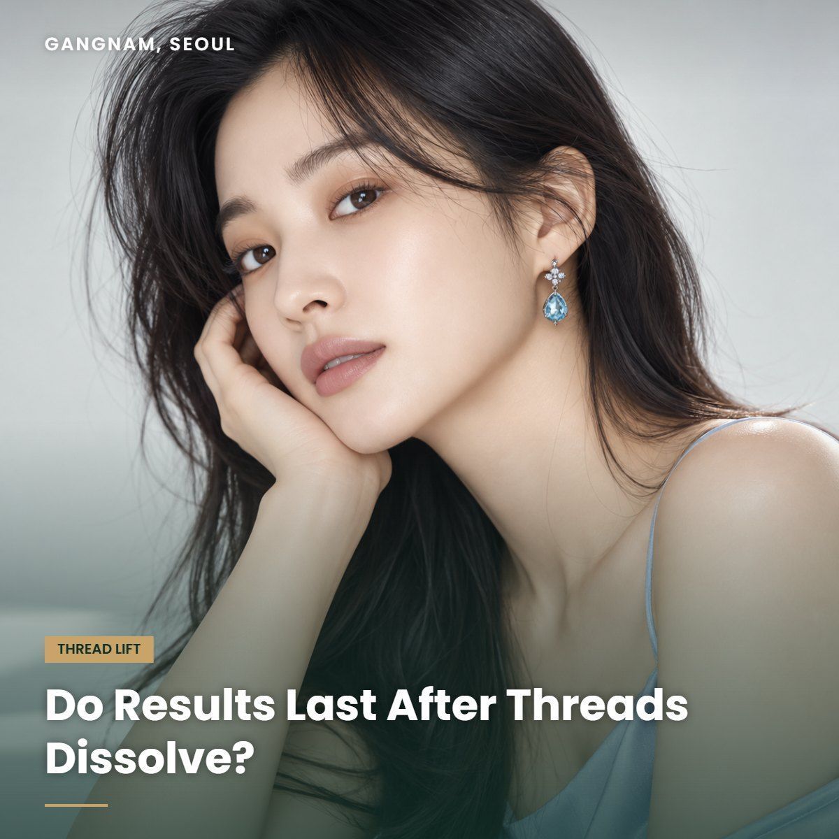 Thread lift results after threads dissolve at YAAN Clinic Gangnam, Seoul