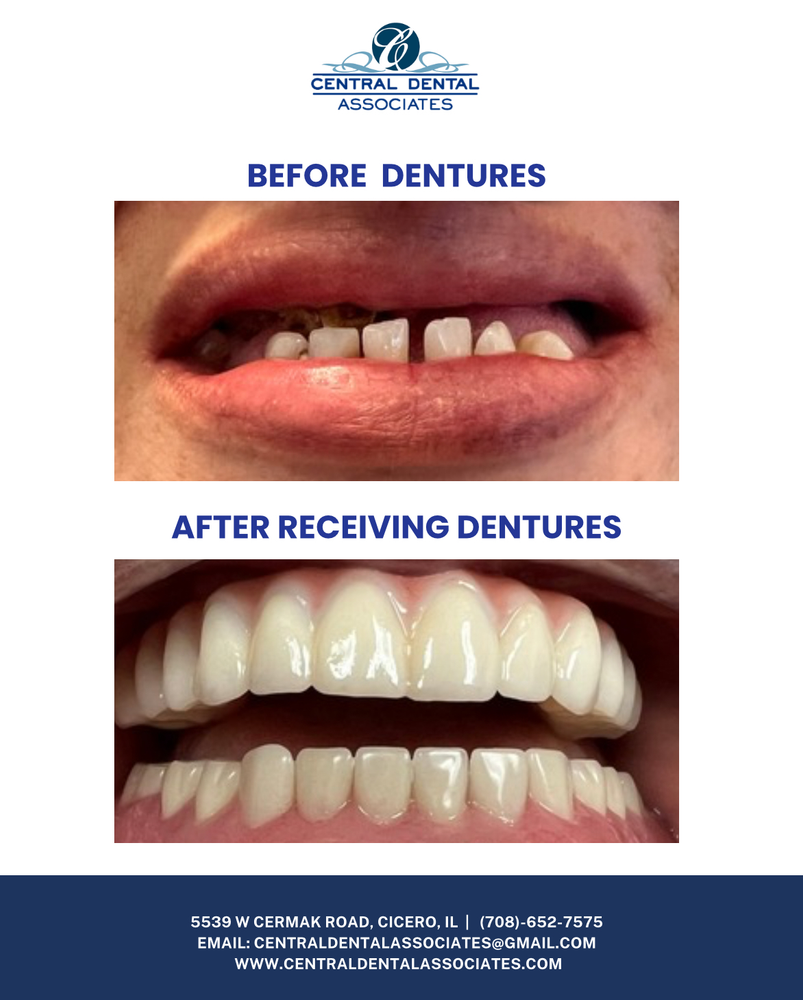 A before and after picture of a person 's teeth