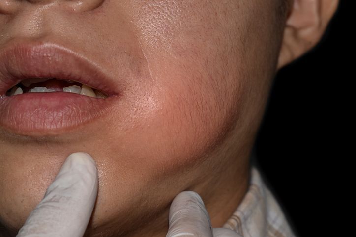 Dental Emergency visit in Cicero, IL 60804