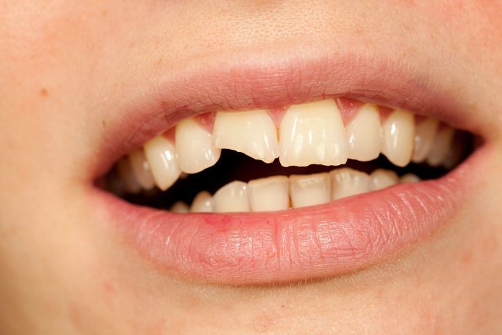Dental Emergency visit in Cicero, IL 60804