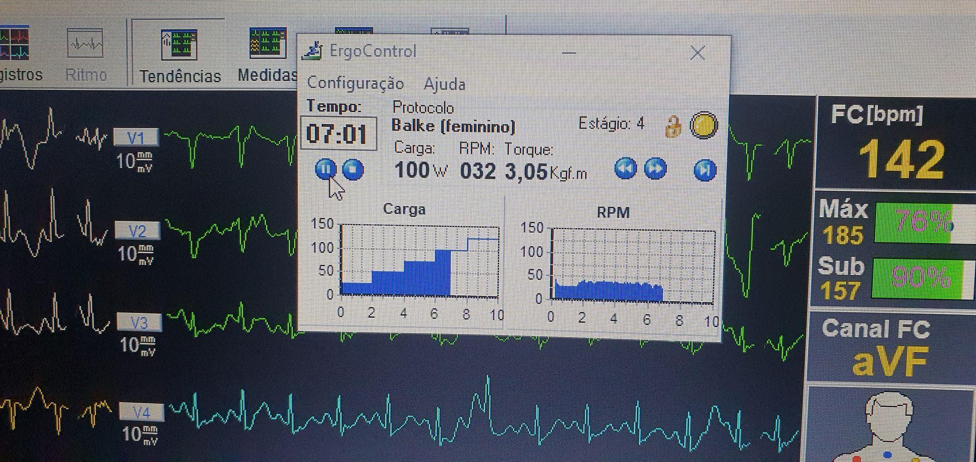 (frequência cardíaca de 142 bpm) e gráficos dos sinais vitais de um paciente.