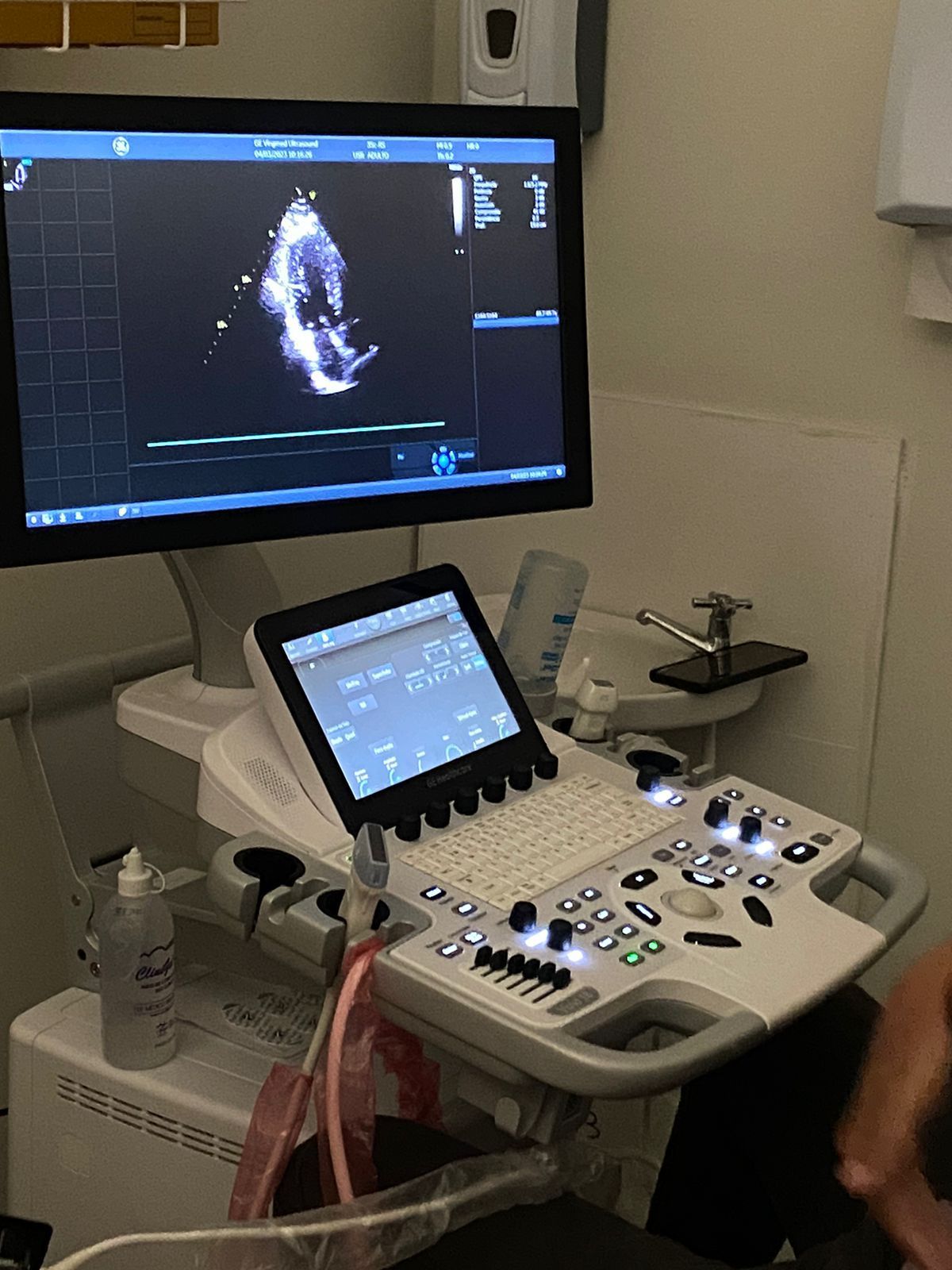 Um aparelho de ultrassom realizando um exame cardíaco em um ambiente médico.