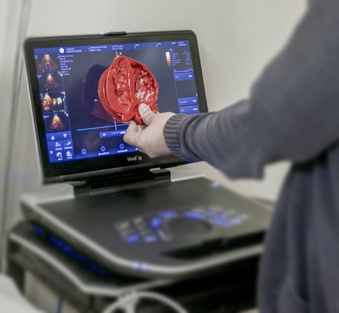 Coração impresso em 3D, comparando-o com uma imagem de ultrassom em um monitor médico.
