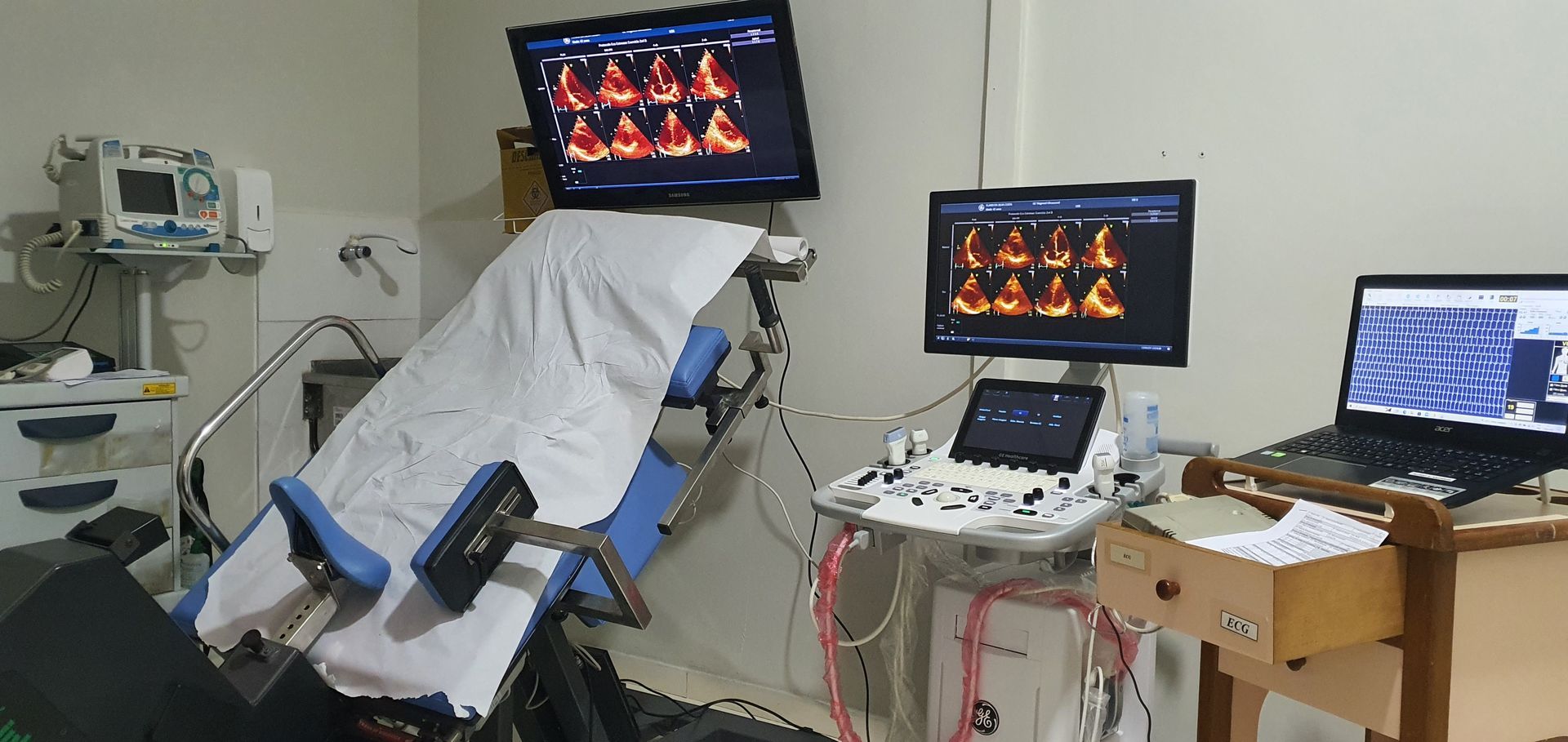 Sala de exames médicos com equipamento de ultrassom e mesa de exames. Monitores exibem imagens de ecocardiografia.