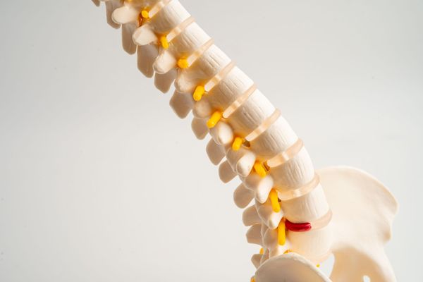 Close-up of a spine model with highlighted yellow and red vertebrae details
