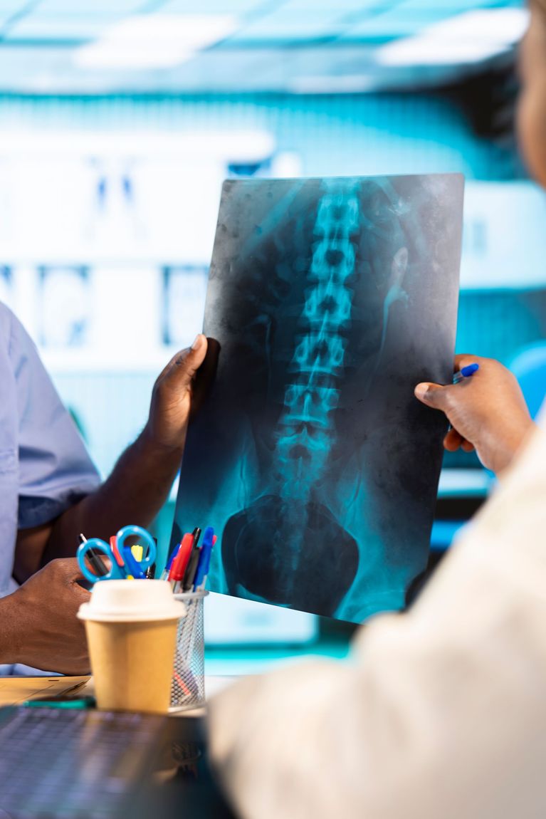 Doctors reviewing an X-ray film with a bright blue spine image on a desk with coffee and pens