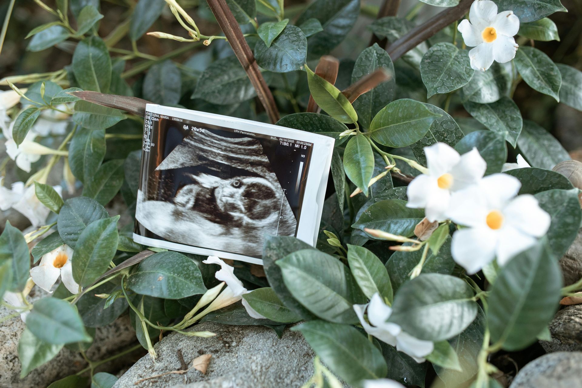 Supporting Employees Through Pregnancy Loss