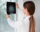 Person in white coat examining an X-ray film in a bright office