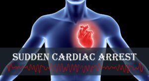 Blue torso with glowing red heart and ECG line; text reads “Sudden Cardiac Arrest”