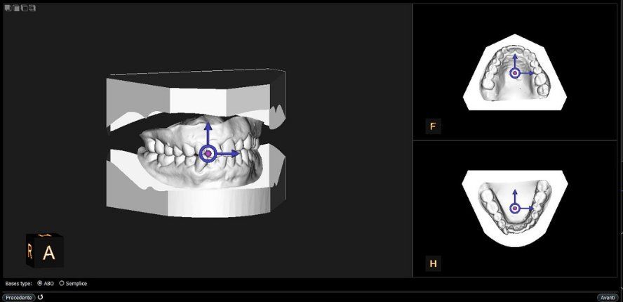 SCANNER INTRAORALE CS 3600 3