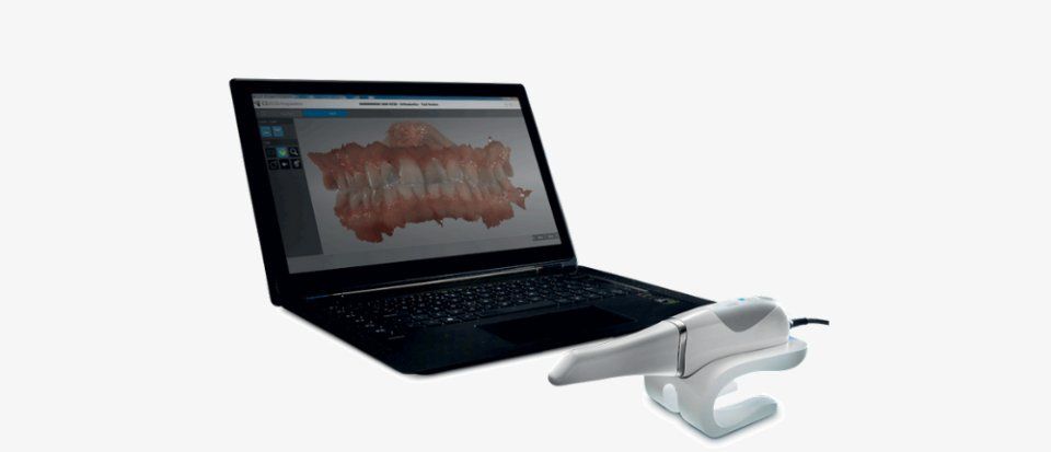 SCANNER INTRAORALE CS 3600 4