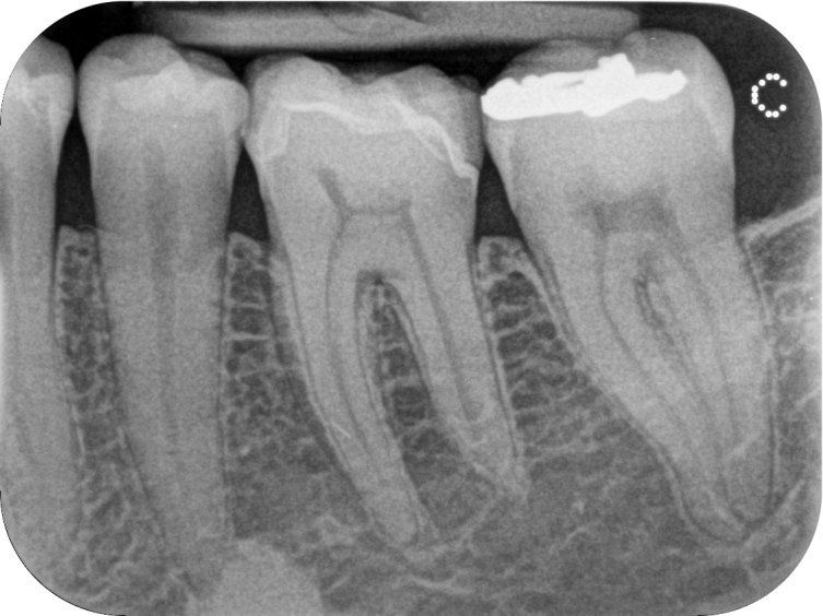 FOSFORI IMAGING CS 7600 3