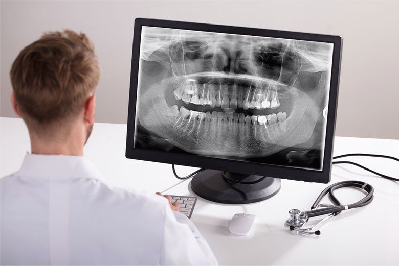 Dentist viewing a dental X-ray on a computer monitor in a clinical office