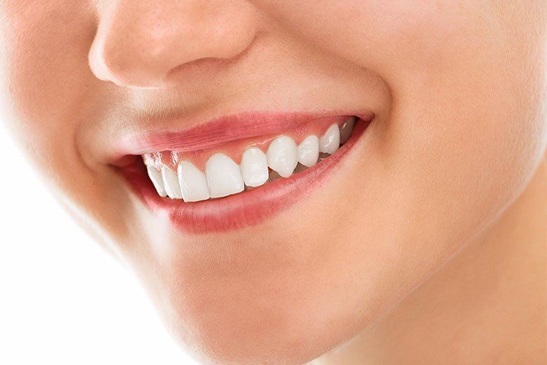 Close-up of a smiling mouth with white teeth and pink lips