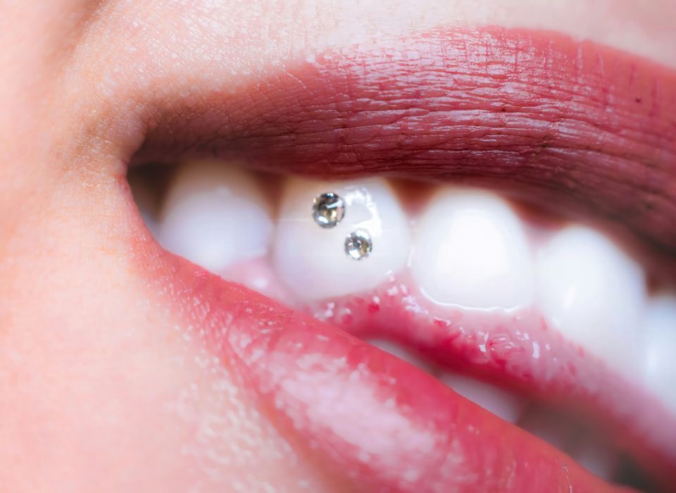 Close-up of lips and teeth with a small silver tooth gem on a front tooth