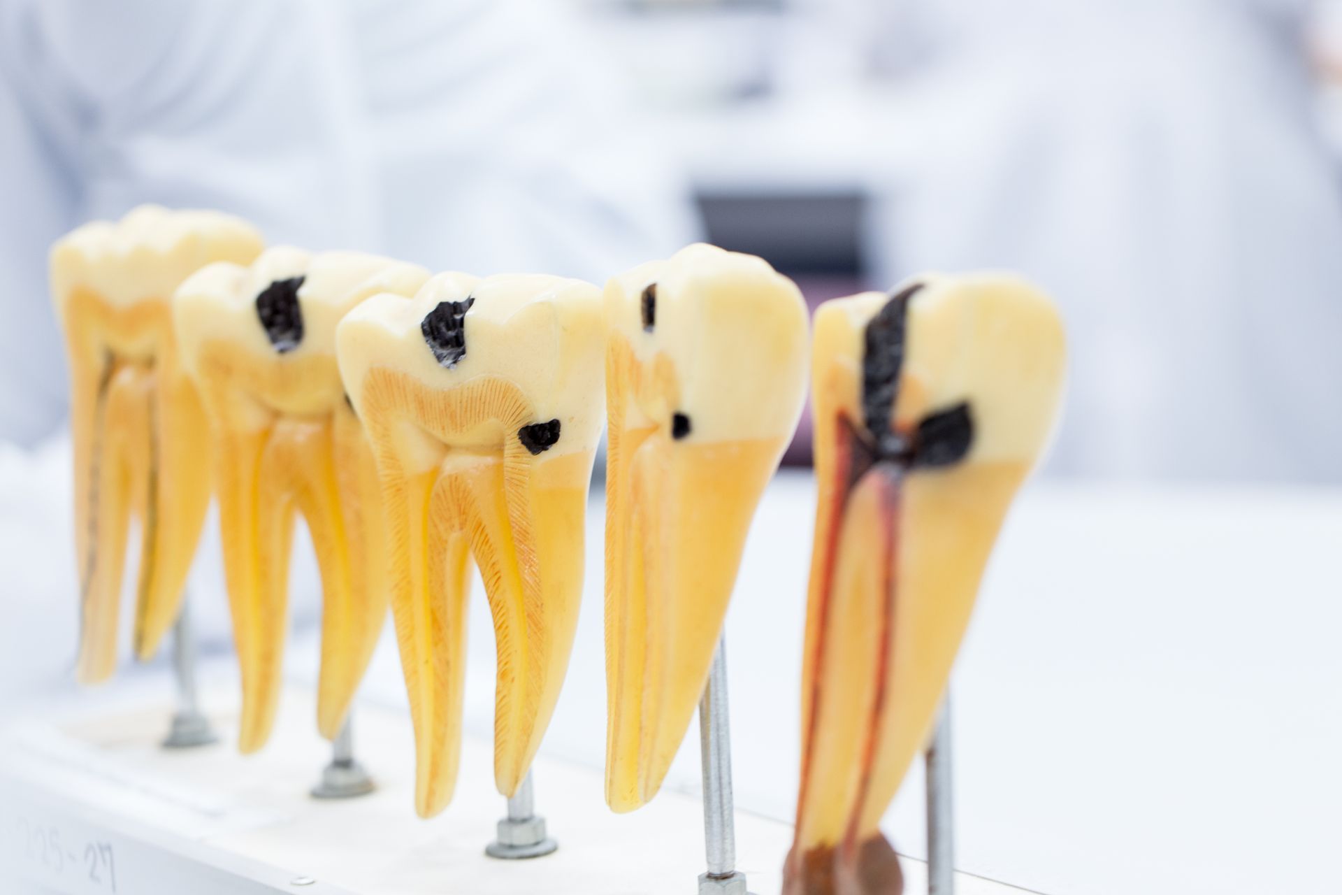 Model of human teeth and roots displayed on stands in a dental office, including a tooth with a crack.
