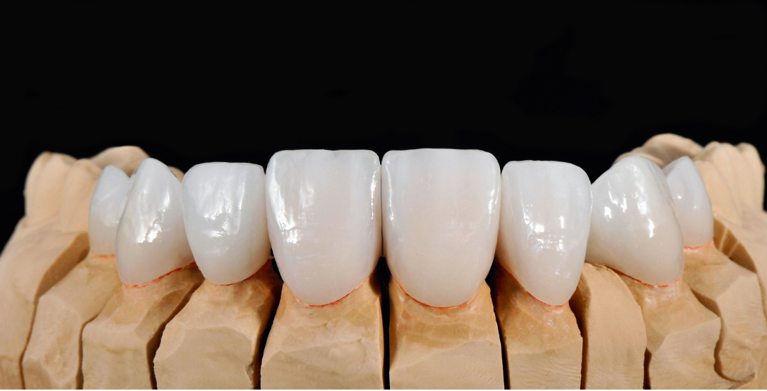 Woman in dental chair having teeth shade matched by a dentist.