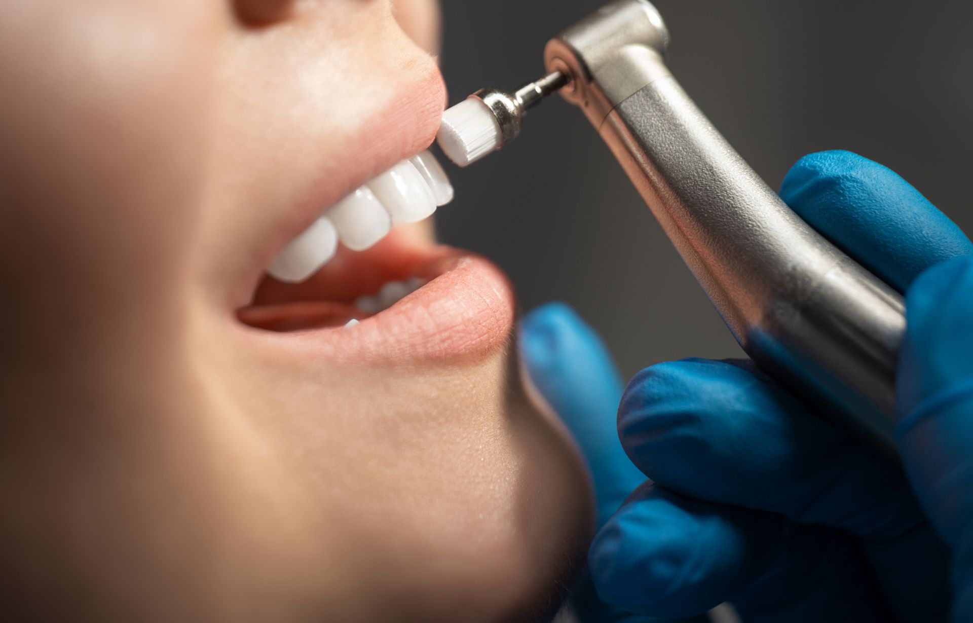 Dentist holding dental drill with blue gloves during oral treatment procedure.