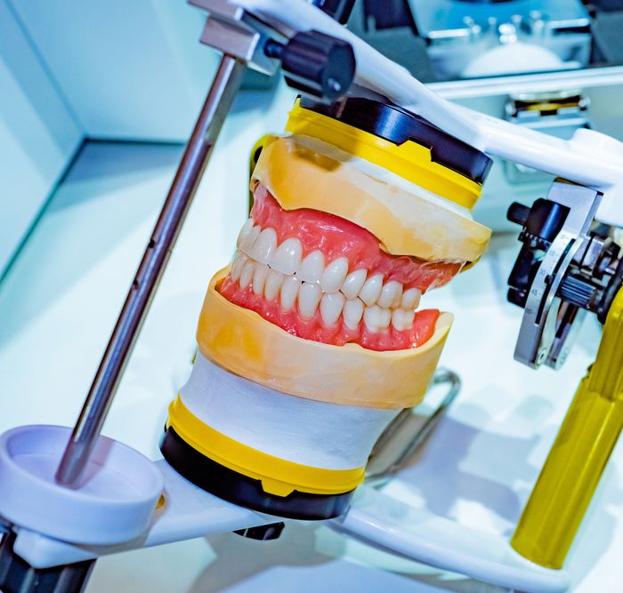 Denture Relining Near Me – Get Affordable and High-Quality Denture Relining Services Today