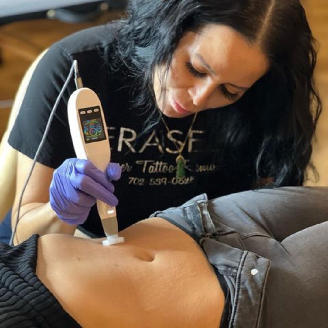 Jet_Plasma_stomach_application