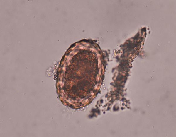 Infección por Helicobacter Pylori