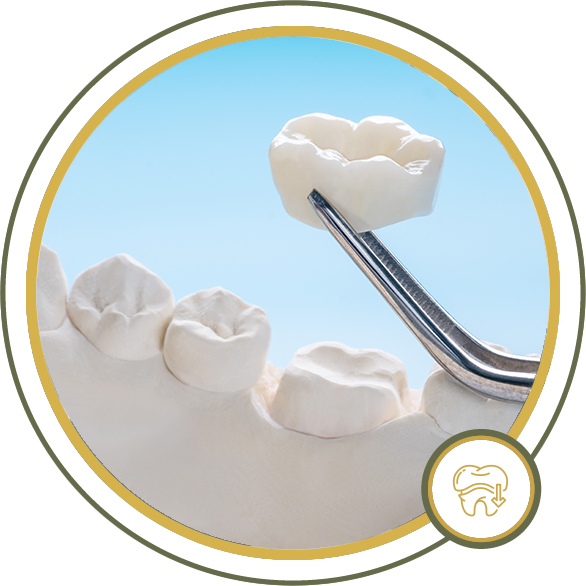 Dental crown being placed on a model of teeth with forceps.