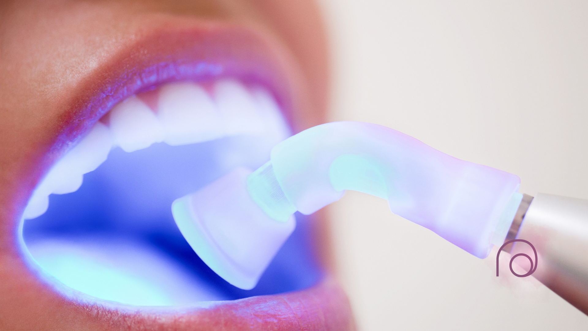 A person undergoing a professional teeth whitening procedure with a blue light applicator.