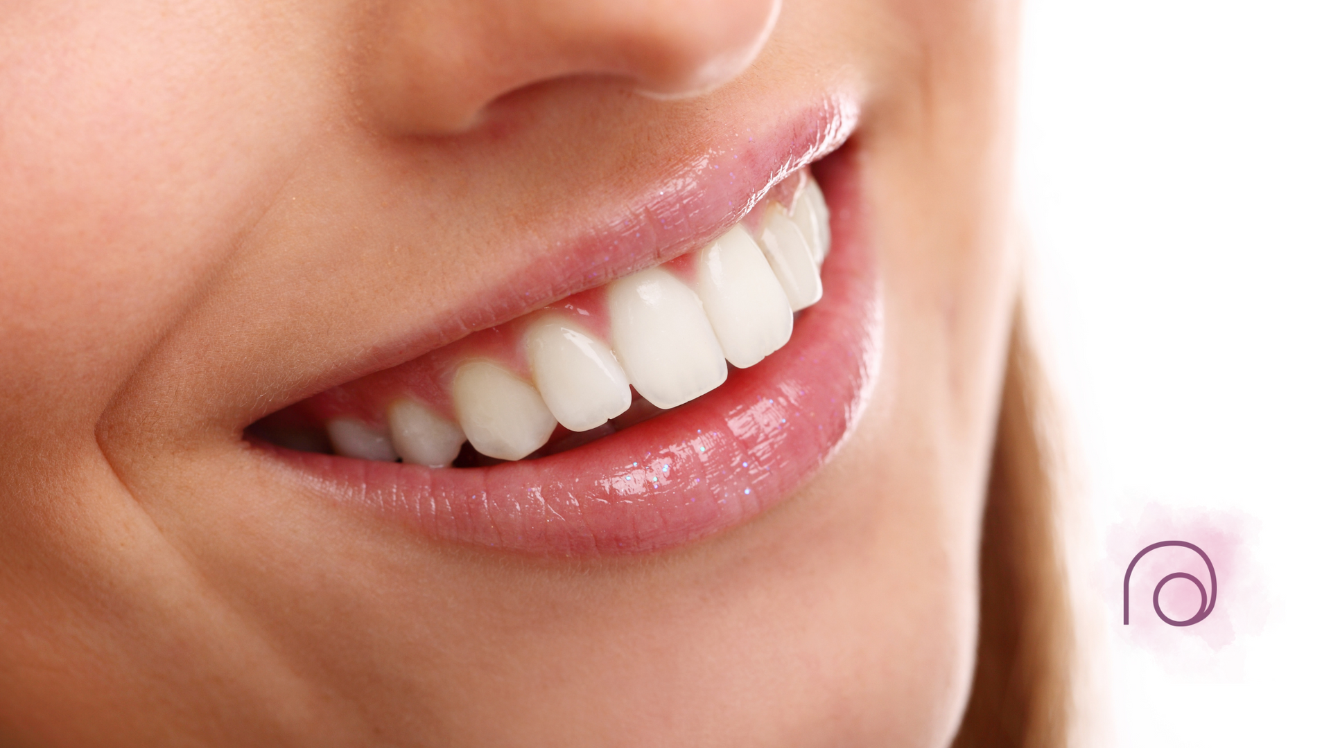 Close-up of a smiling woman's mouth, showing bright white teeth and glossy pink lips.