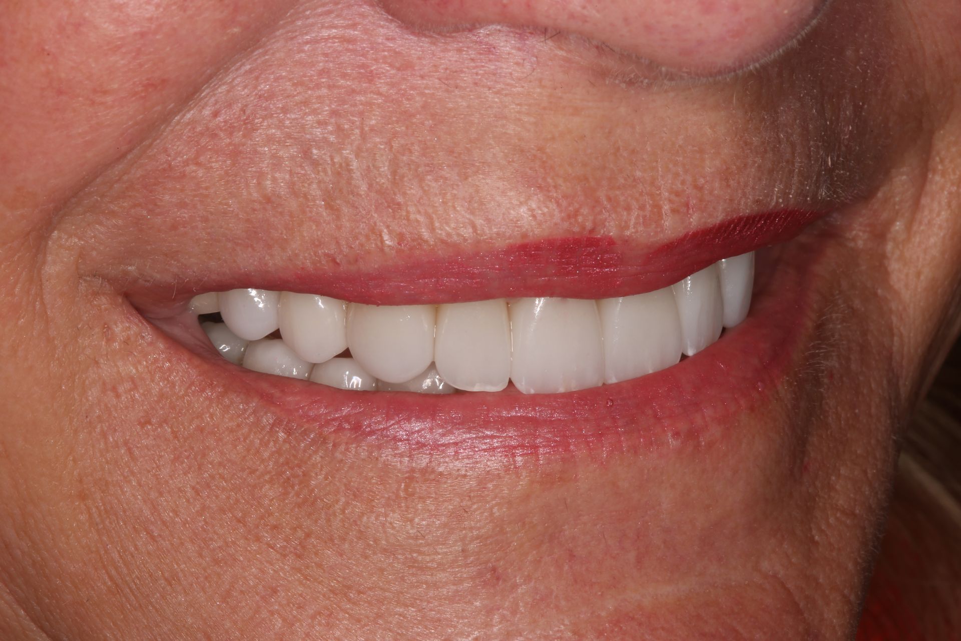 Close-up of a person smiling, showing a full set of bright white teeth and red lipstick.
