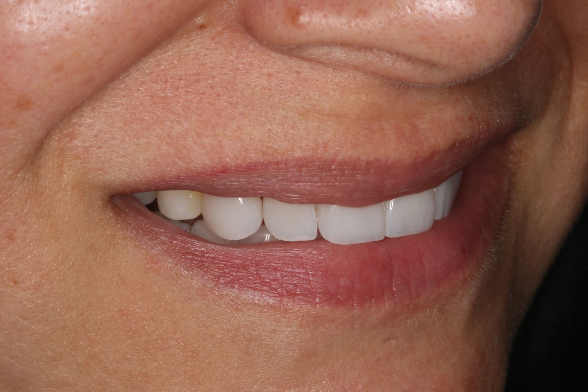 Close-up of a person smiling, showing their teeth and lips.