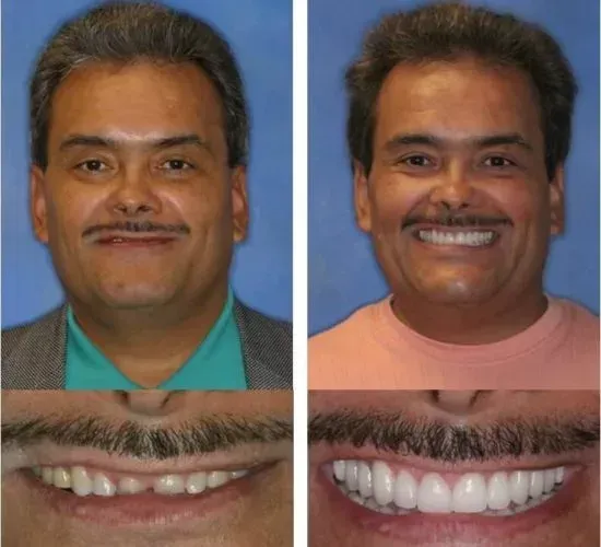 A before and after photo of a man with a mustache