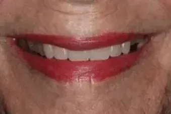 A close up of a person 's mouth with white teeth.