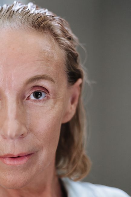 Woman with fresh, natural-looking skin after natural anti-aging treatment in Seoul