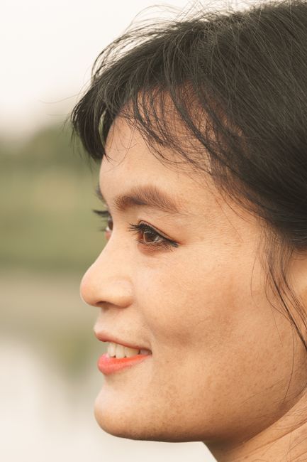Woman with fine lines around the eyes considering wrinkle treatment in Seoul