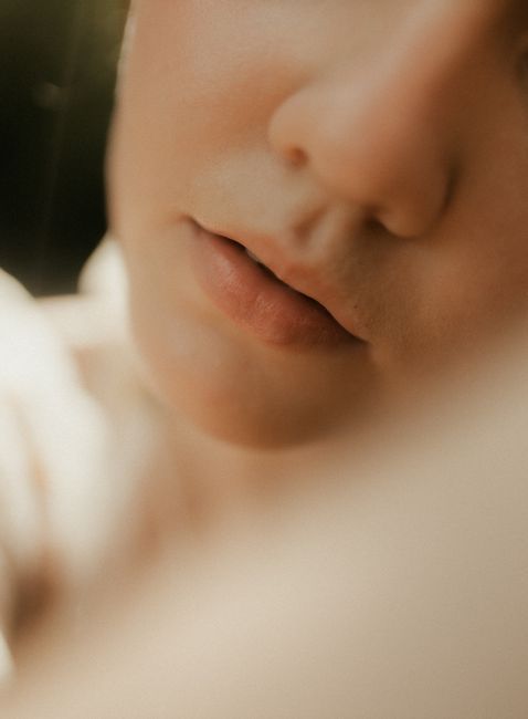 Smoother skin texture after acne scar treatment at The Heal Dermatology, Jamsil, Seoul