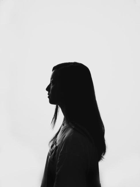 Balanced side profile after chin filler in Seoul