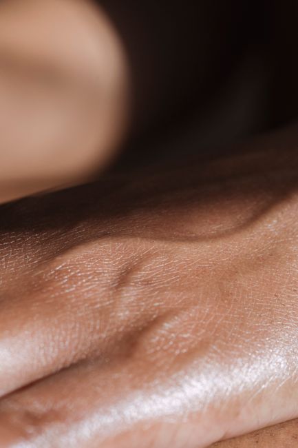 Smoother skin texture after acne scar and pore treatment in Seoul