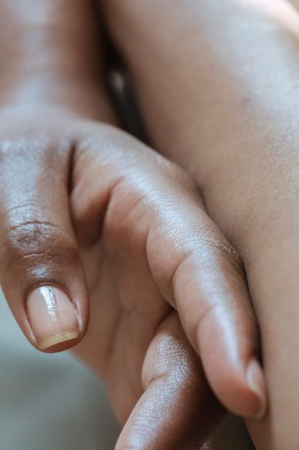 Removal of warts, milia and skin tags by a dermatologist at The Heal in Jamsil, Seoul