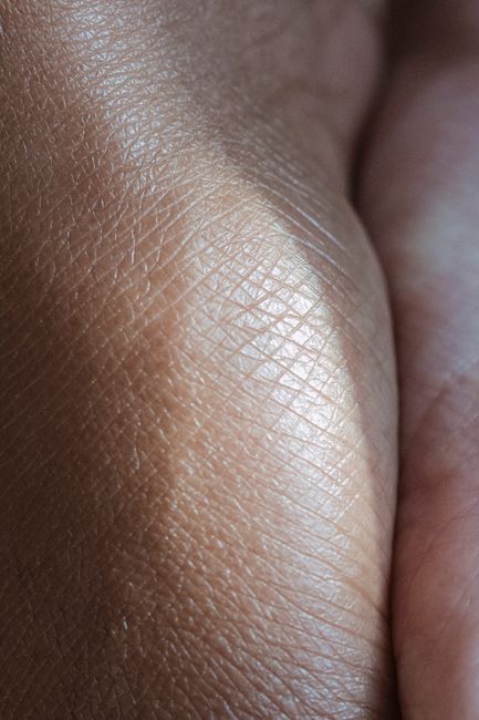 Close-up of smooth, refined skin after skin Botox in Seoul
