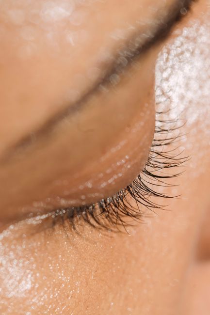 Close-up of smooth skin with refined pores after treatment in Seoul