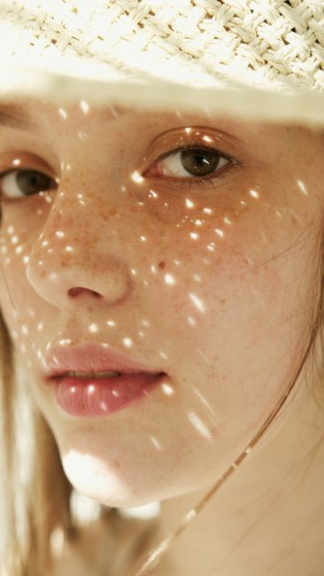 StarWalker laser treatment for pigment spots at The Heal Dermatology, Jamsil, Seoul