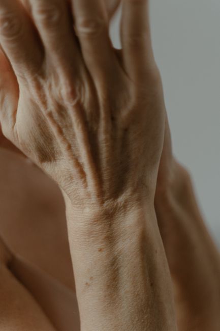 Mature woman with thin, delicate skin considering skin boosters in Seoul