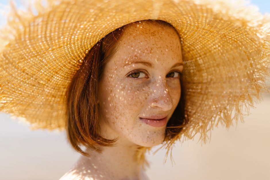 Close-up of a woman with facial freckles considering freckle treatment in Seoul
