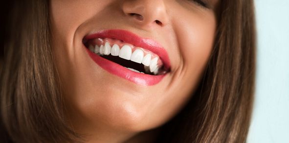 After Smile Gallery