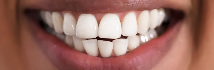 Smile Gallery