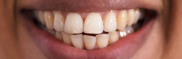 Smile Gallery
