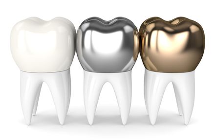 Metal or Gold Crowns