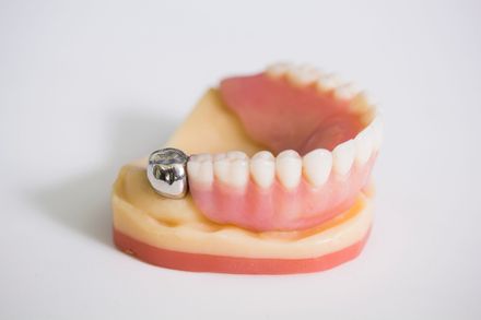 Steel Crowns